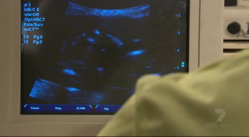 12ultrasound.png