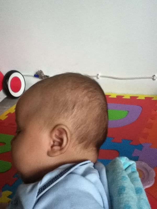 Flat head baby, should I worry? (pic included) BabyCenter