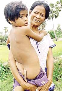 Cambodian Babies