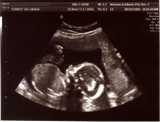 18w 5d