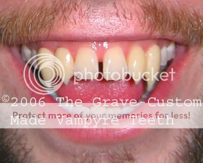 The Grave-Custom Made Vampyre Teeth